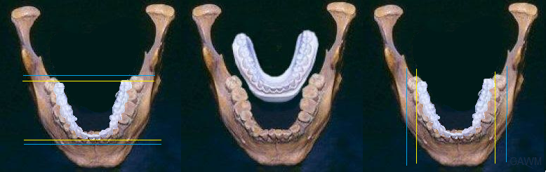 jaws repeated left to right, teeth overlayed giant jaw with horizontal lines. teeth behind jaw, repeated with vertical lines