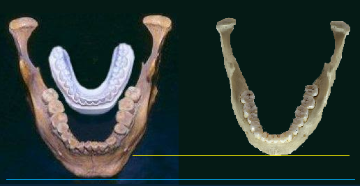 black background, giant teeth with average mold behind on left, on the right an average jaw/